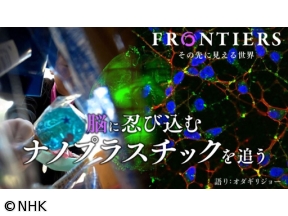 フロンティア　脳に忍び込むナノプラスチックを追う