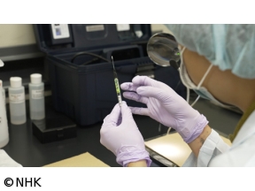 フロンティア　脳に忍び込むナノプラスチックを追う