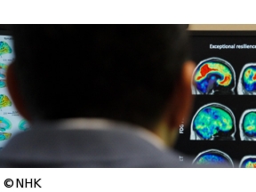 フロンティア　認知症“克服のカギ”を求めて