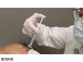 所さん！事件ですよ　3歳から脱毛サロンに！？“毛”の最新事情